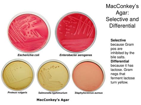 nutrient agar selective or differential